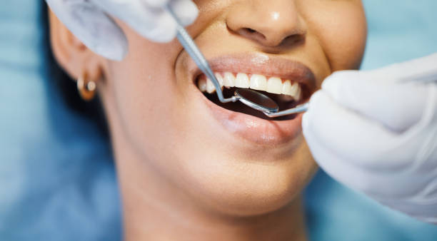 Best Emergency Root Canal Treatment in Lilburn, GA