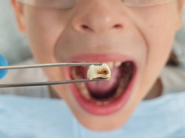 Best Emergency Denture Repair in Lilburn, GA