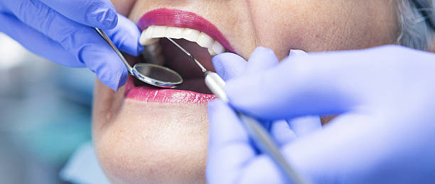 Best Emergency Dental Care for Broken or Chipped Teeth in Lilburn, GA